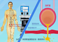 人和醫(yī)院 尿潴留、尿失禁動(dòng)畫